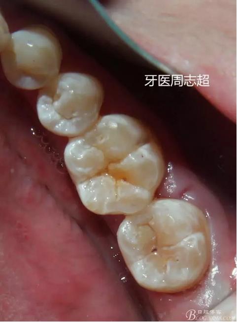 360截圖20170120150343481.jpg 360截圖20170120150343481.jpg