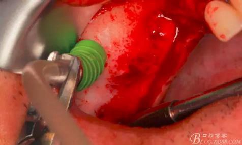 360截圖20170120155705741.jpg 360截圖20170120155705741.jpg