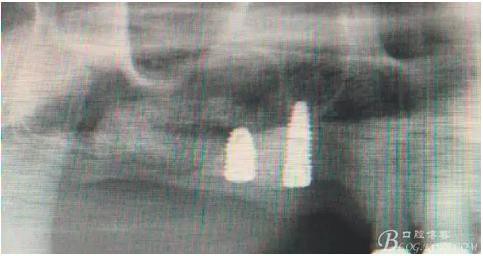 360截圖20170120155918215.jpg 360截圖20170120155918215.jpg