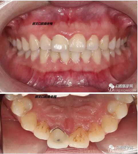 360截圖20170120163738177.jpg 360截圖20170120163738177.jpg