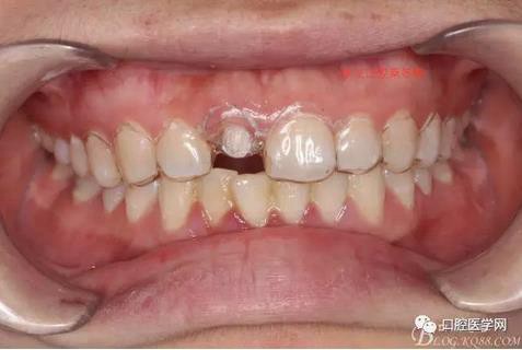 360截圖20170120163816908.jpg 360截圖20170120163816908.jpg