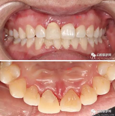 360截圖20170120163918884.jpg 360截圖20170120163918884.jpg