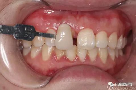 360截圖20170120163956654.jpg 360截圖20170120163956654.jpg