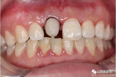 360截圖20170120164024630.jpg 360截圖20170120164024630.jpg