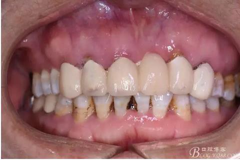 360截圖20170121151635005.jpg 360截圖20170121151635005.jpg