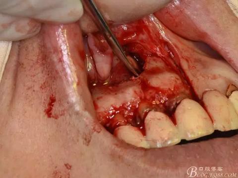 360截圖20170121151744780.jpg 360截圖20170121151744780.jpg