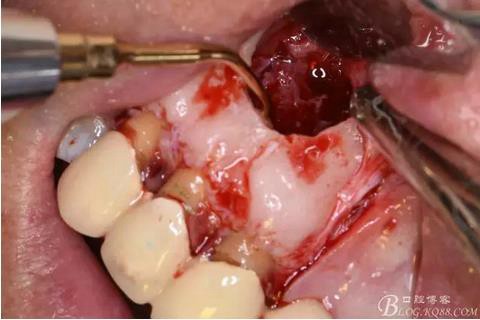 360截圖20170121151907429.jpg 360截圖20170121151907429.jpg