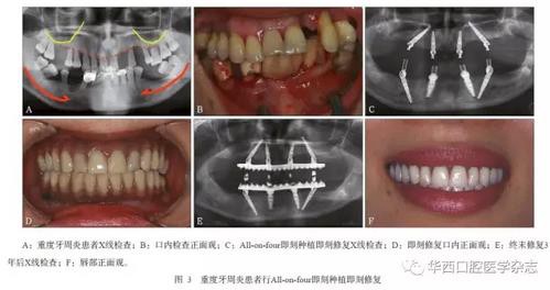 360截圖20170121155932551.jpg 360截圖20170121155932551.jpg