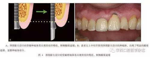 360截圖20170121155940215.jpg 360截圖20170121155940215.jpg