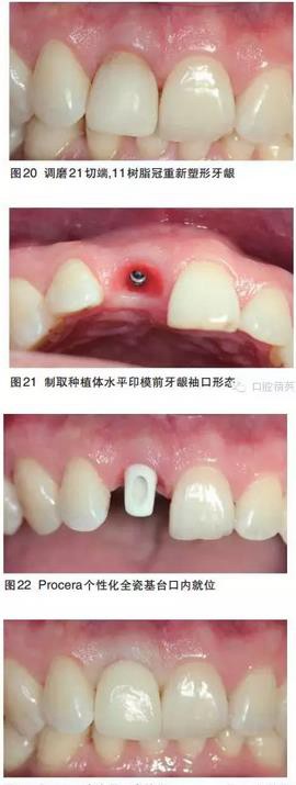 360截圖20170122103951487.jpg 360截圖20170122103951487.jpg