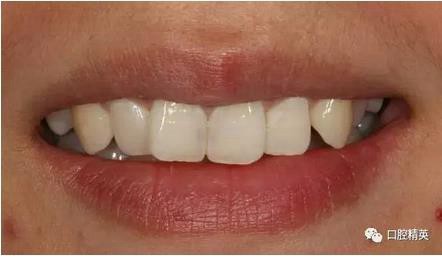 360截圖20170122111042447.jpg 360截圖20170122111042447.jpg