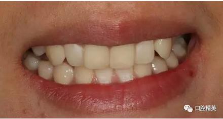 360截圖20170122111307960.jpg 360截圖20170122111307960.jpg