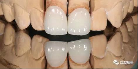 360截圖20170122111356264.jpg 360截圖20170122111356264.jpg