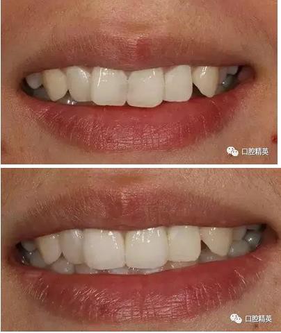 360截圖20170122111514560.jpg 360截圖20170122111514560.jpg