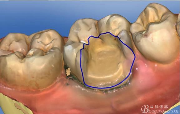 360截圖20170122165742377.jpg 360截圖20170122165742377.jpg