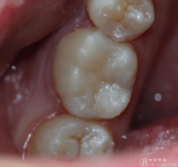 360截圖20170122170035625.jpg 360截圖20170122170035625.jpg