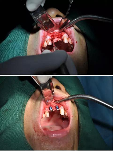 360截圖20170123085930476.jpg 360截圖20170123085930476.jpg