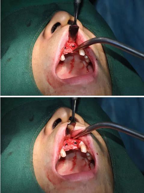 360截圖20170123085943081.jpg 360截圖20170123085943081.jpg