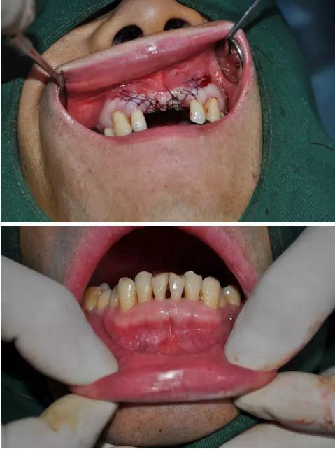 360截圖20170123090005500.jpg 360截圖20170123090005500.jpg