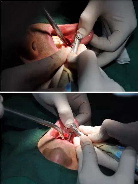 360截圖20170123090059044.jpg 360截圖20170123090059044.jpg