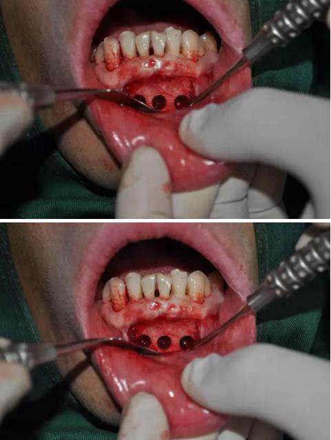 360截圖20170123090220141.jpg 360截圖20170123090220141.jpg