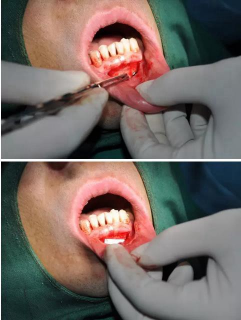 360截圖20170123090230943.jpg 360截圖20170123090230943.jpg