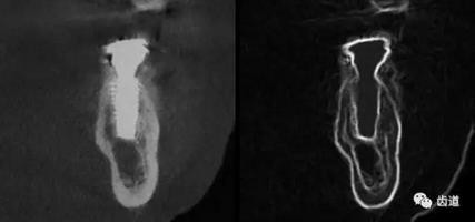 360截圖20170123164718698.jpg 360截圖20170123164718698.jpg