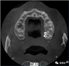 360截圖20170124104308406.jpg 360截圖20170124104308406.jpg