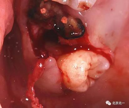 360截圖20170124104411590.jpg 360截圖20170124104411590.jpg