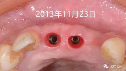 360截圖20170124115138434.jpg 360截圖20170124115138434.jpg