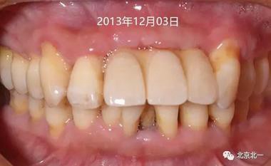 360截圖20170124115154789.jpg 360截圖20170124115154789.jpg