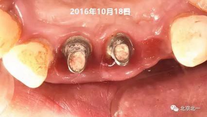 360截圖20170124115210520.jpg 360截圖20170124115210520.jpg