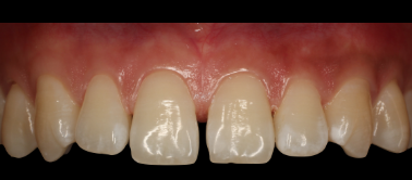 圖片9.png 圖片9.png