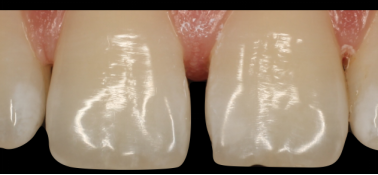 圖片11.png 圖片11.png