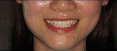 圖片28.png 圖片28.png