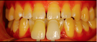 圖片25.png 圖片25.png