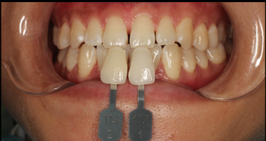 圖片23.png 圖片23.png