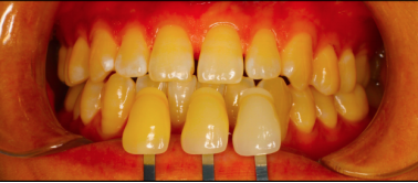 圖片22.png 圖片22.png