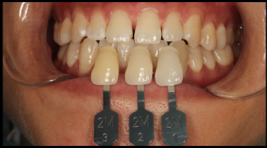 圖片20.png 圖片20.png