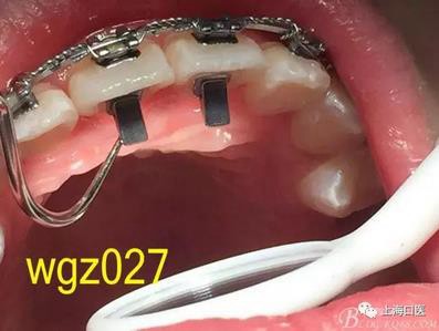 360截圖20170125142325792.jpg 360截圖20170125142325792.jpg