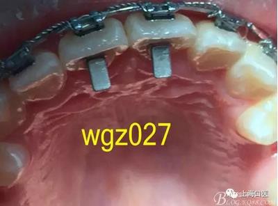 360截圖20170125142332696.jpg 360截圖20170125142332696.jpg