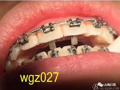 360截圖20170125142341926.jpg 360截圖20170125142341926.jpg