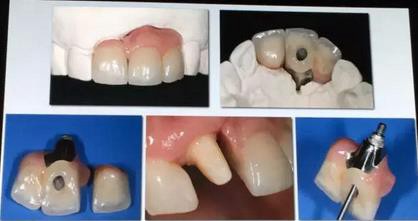 360截圖20170125150513746.jpg 360截圖20170125150513746.jpg