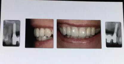 360截圖20170125150530923.jpg 360截圖20170125150530923.jpg