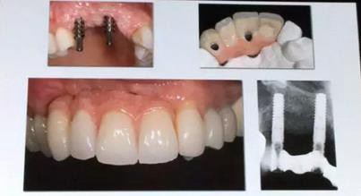 360截圖20170125150540332.jpg 360截圖20170125150540332.jpg