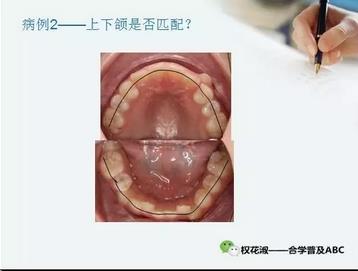 360截圖20170125210313470.jpg 360截圖20170125210313470.jpg