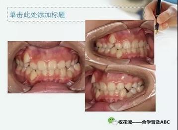 360截圖20170125210322511.jpg 360截圖20170125210322511.jpg