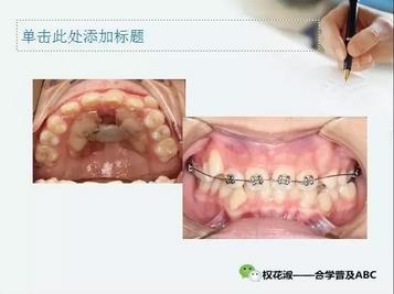 360截圖20170125210359039.jpg 360截圖20170125210359039.jpg