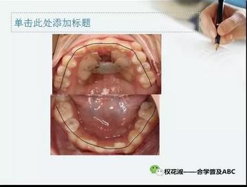 360截圖20170125210406519.jpg 360截圖20170125210406519.jpg