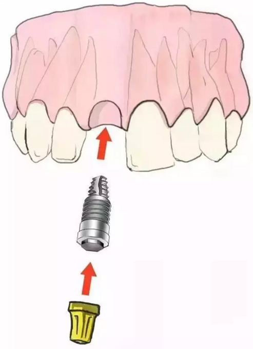 640 (600&times;809).png